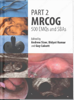 Part 2 MRCOG: 500 EMQs and SBAs